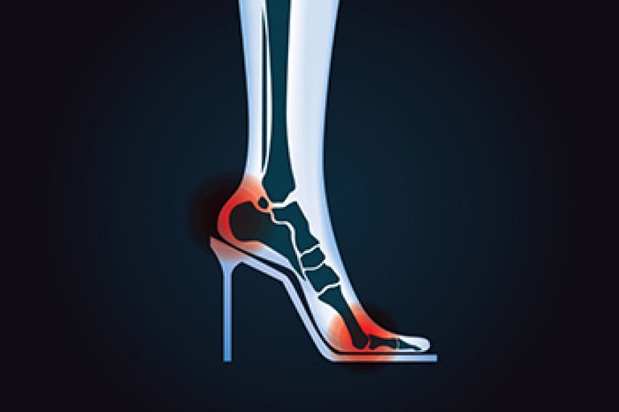 ways-to-reduce-pain-from-high-heels